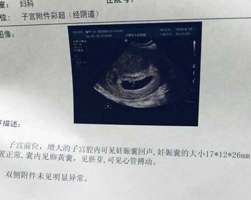 国内代孕需要多少钱,试管婴儿的适应症主要解决不育